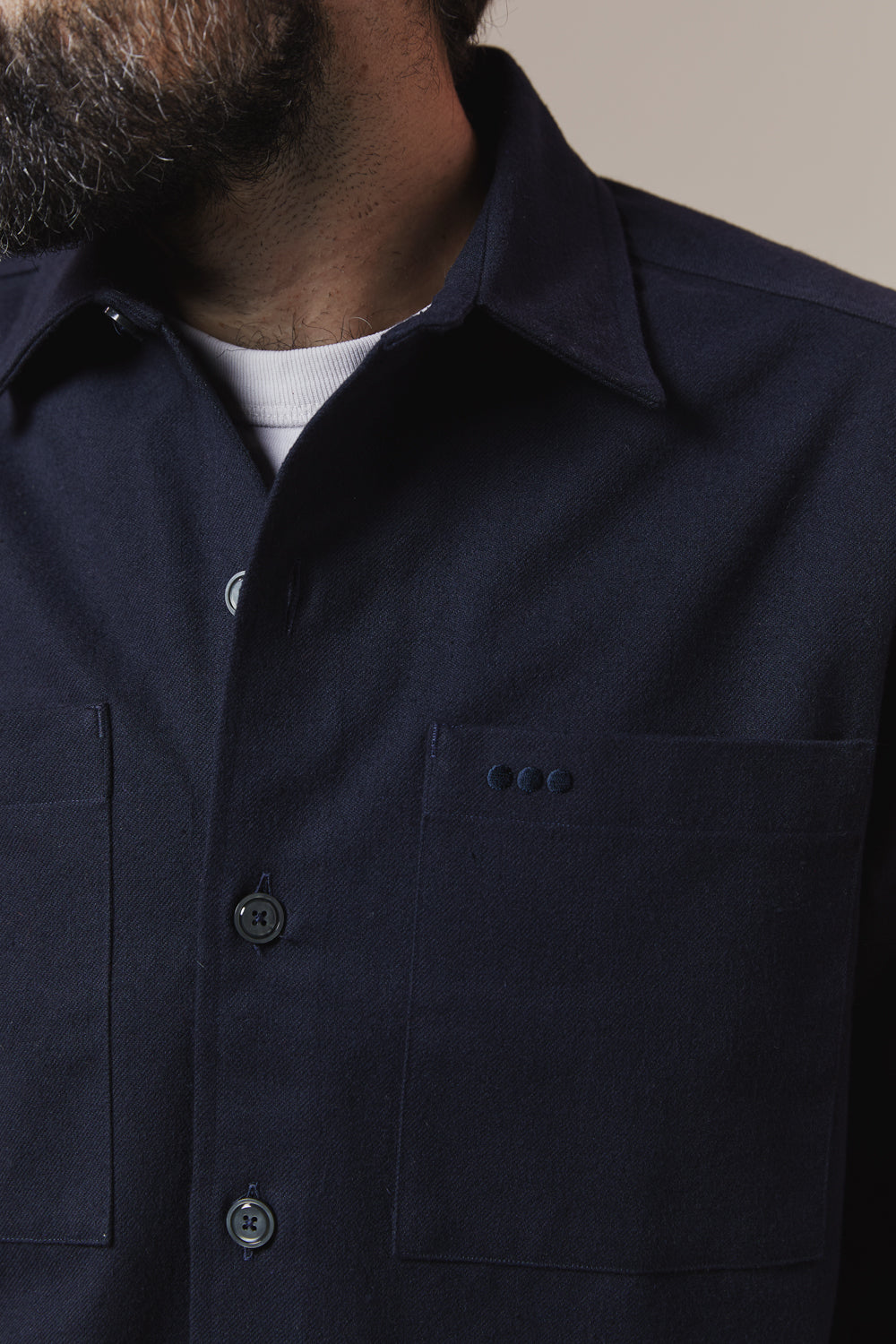 CASUAL overshirt